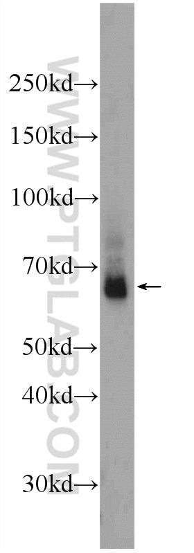 Western Blot (WB) analysis of mouse brain tissue using LARGE Polyclonal antibody (24307-1-AP)