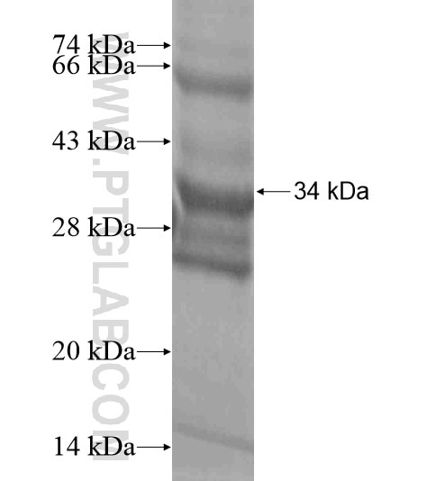 LARGE fusion protein Ag19458 SDS-PAGE
