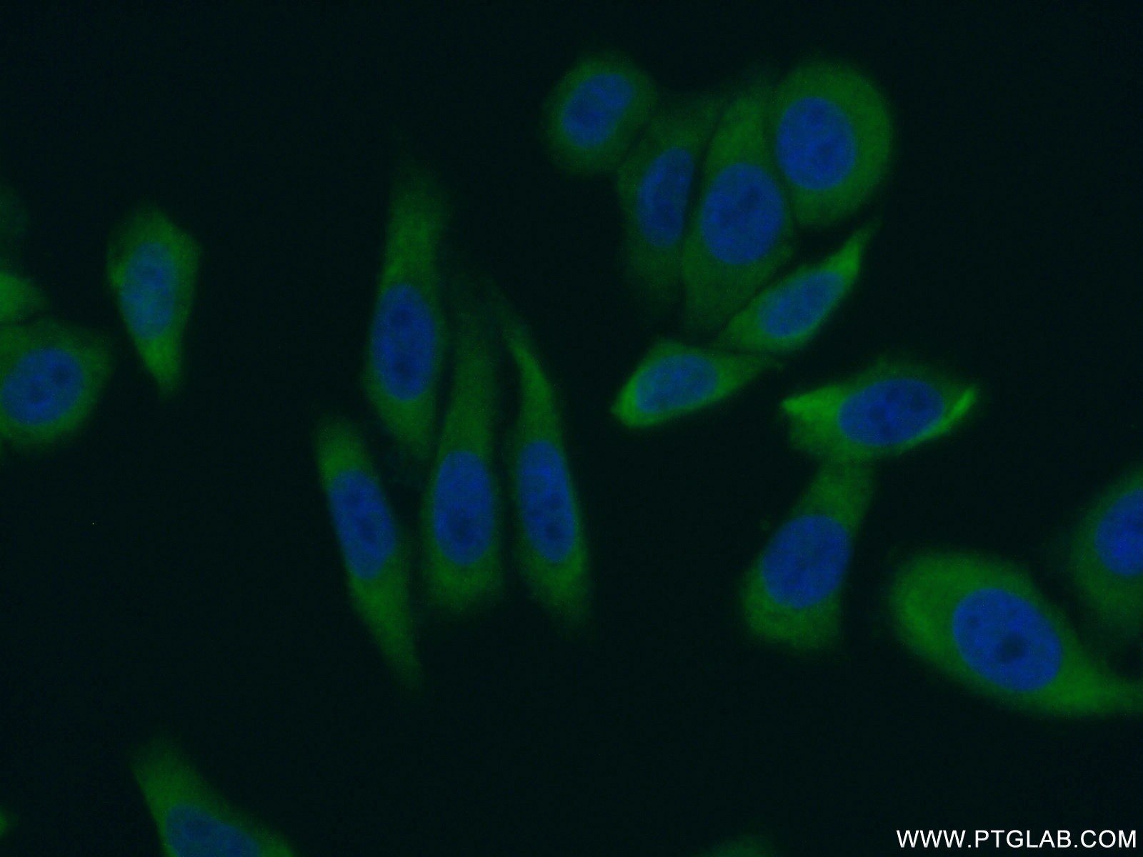 Immunofluorescence (IF) / fluorescent staining of HepG2 cells using LARP1 Polyclonal antibody (13708-1-AP)
