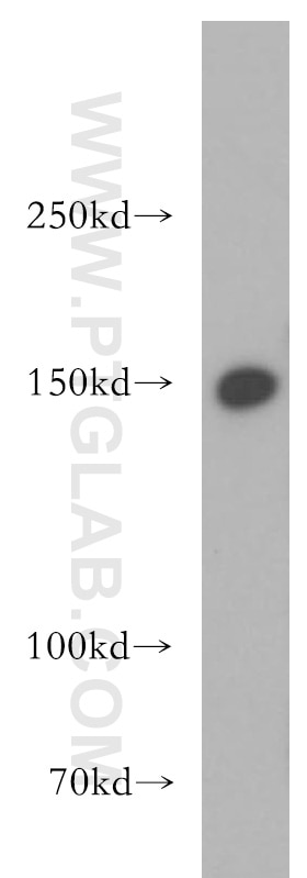 Western Blot (WB) analysis of HeLa cells using LARP1 Polyclonal antibody (13708-1-AP)