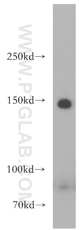 Western Blot (WB) analysis of HepG2 cells using LARP1 Polyclonal antibody (13708-1-AP)