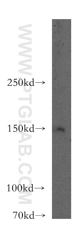 Western Blot (WB) analysis of mouse heart tissue using LARP1 Polyclonal antibody (13708-1-AP)