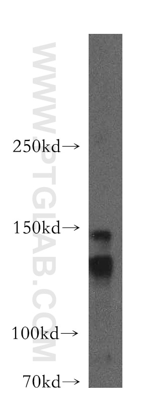 Western Blot (WB) analysis of mouse testis tissue using LARP1 Polyclonal antibody (13708-1-AP)