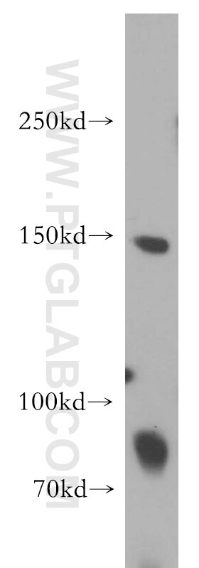 Western Blot (WB) analysis of mouse brain tissue using LARP1 Polyclonal antibody (13708-1-AP)