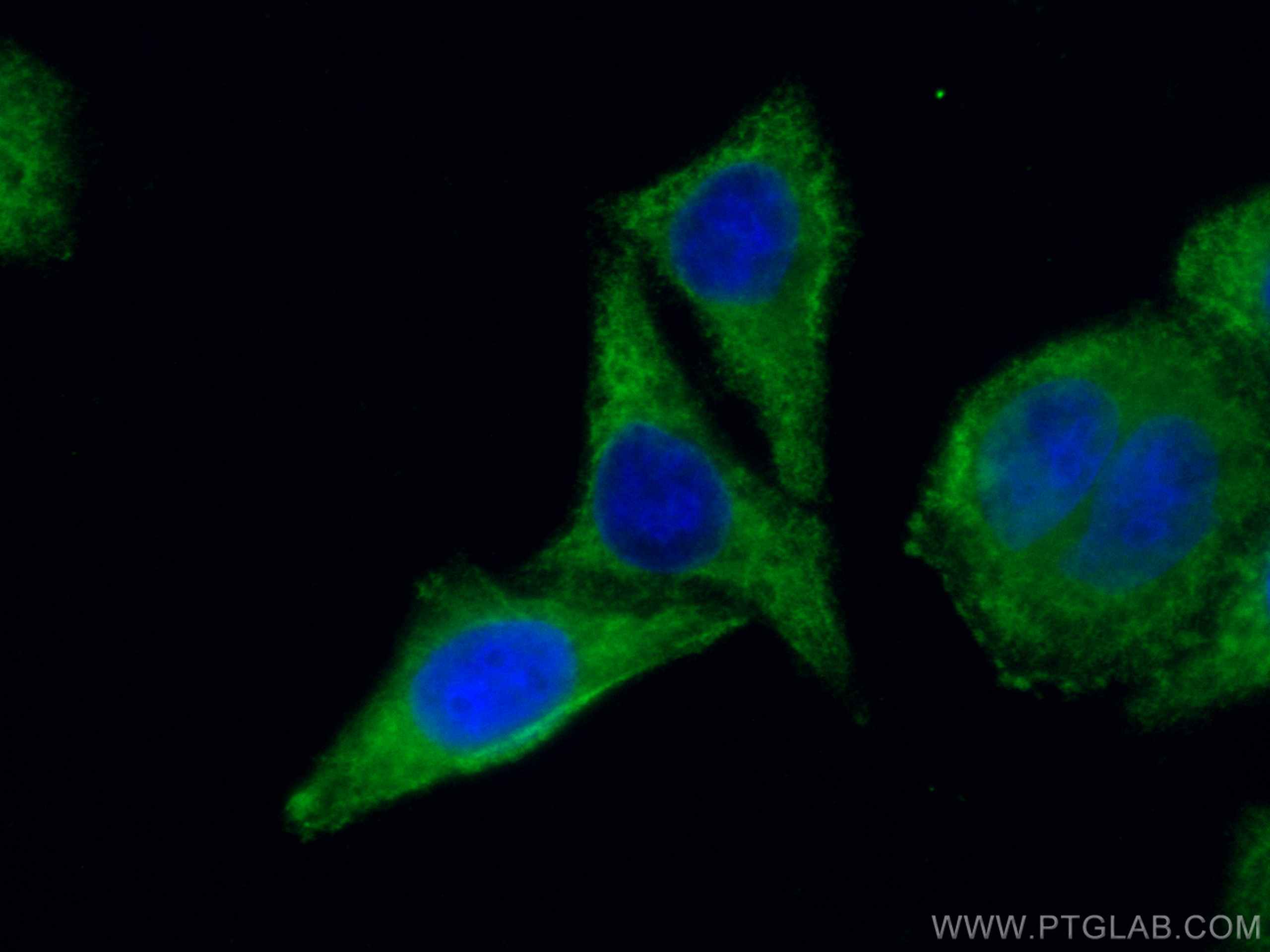 Immunofluorescence (IF) / fluorescent staining of HepG2 cells using LARP1 Monoclonal antibody (67810-1-Ig)
