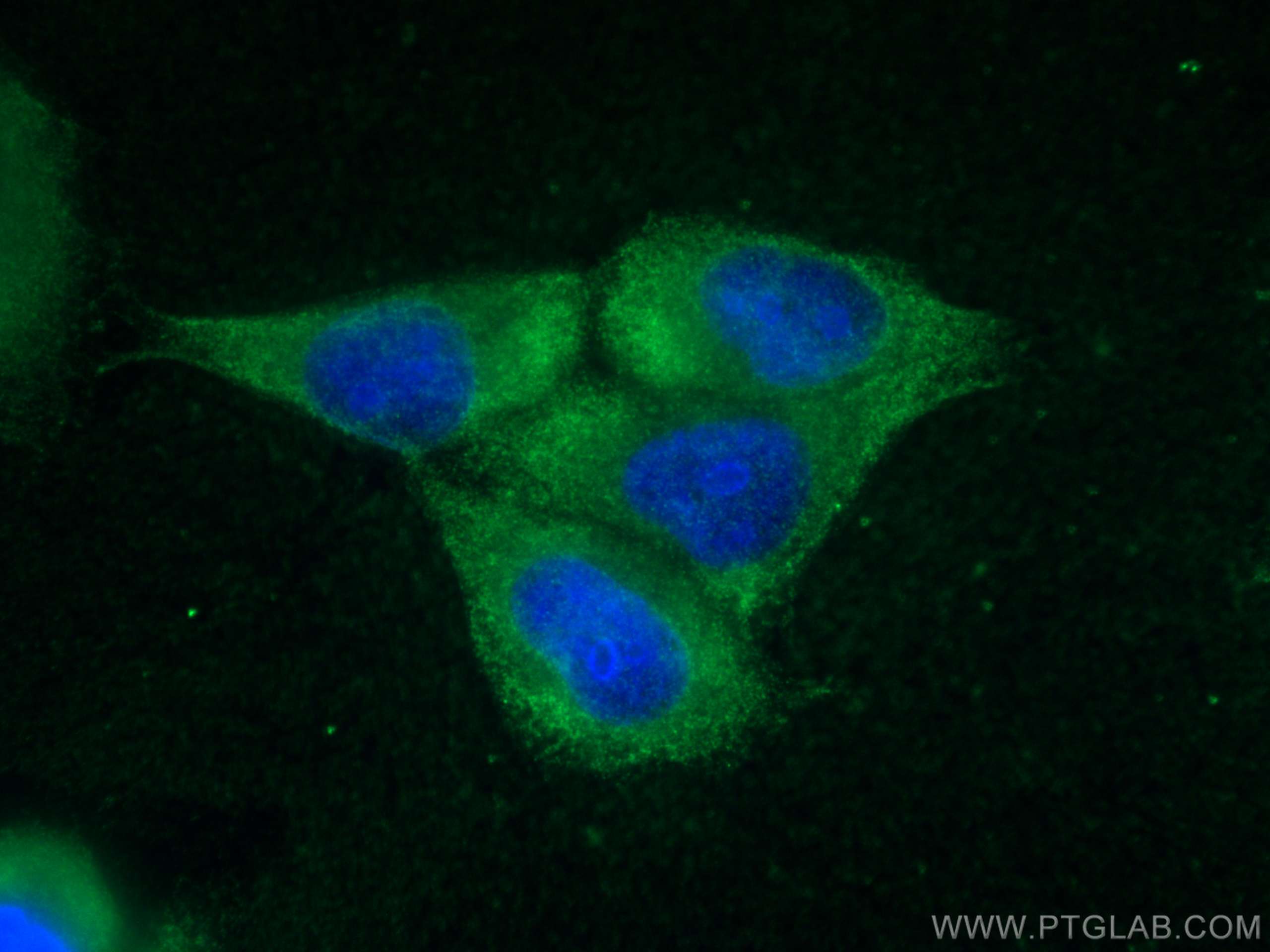 Immunofluorescence (IF) / fluorescent staining of HepG2 cells using LARP1 Monoclonal antibody (67810-1-Ig)