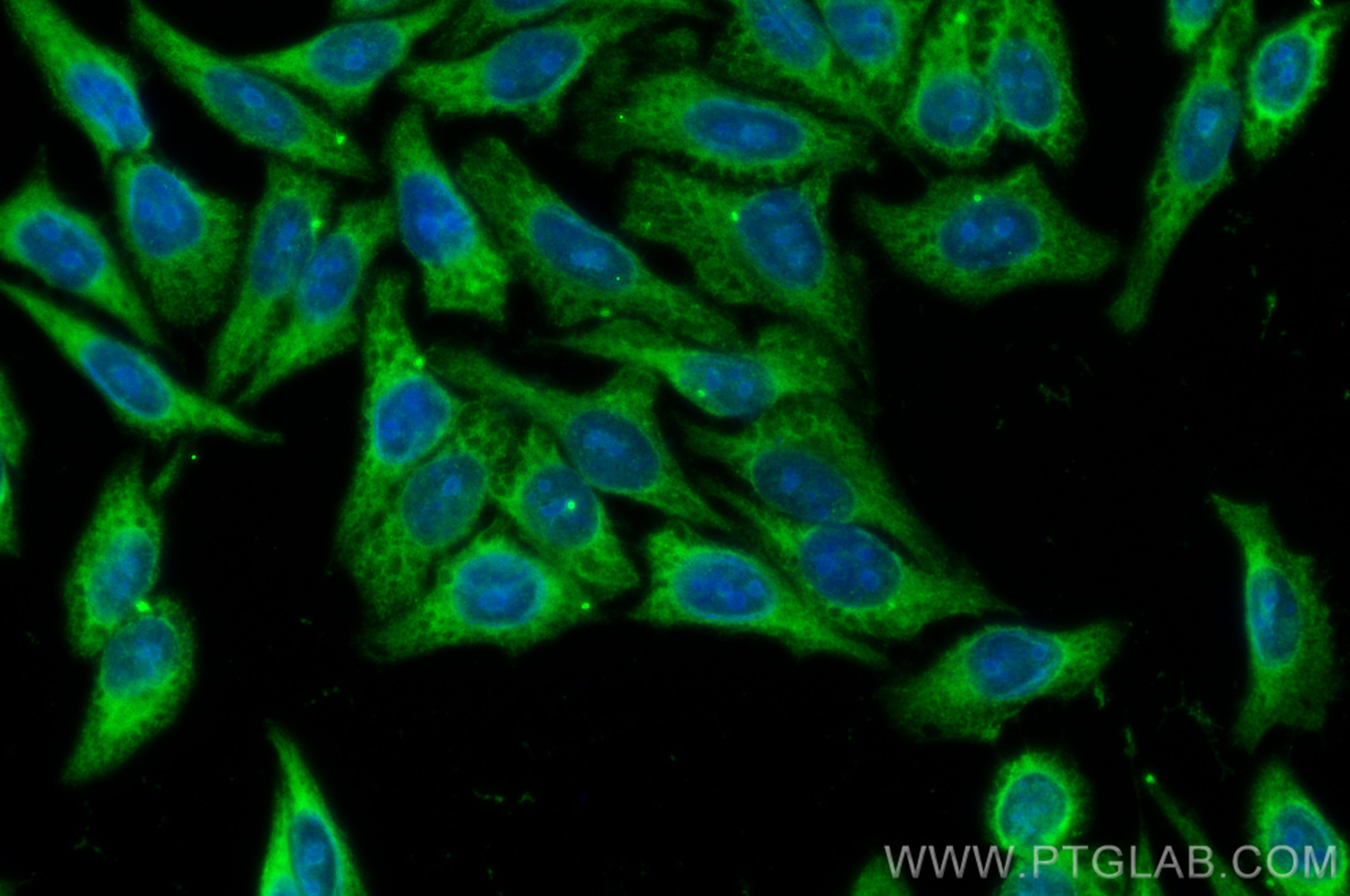 Immunofluorescence (IF) / fluorescent staining of HepG2 cells using CoraLite® Plus 488-conjugated LARP1 Polyclonal ant (CL488-13708)