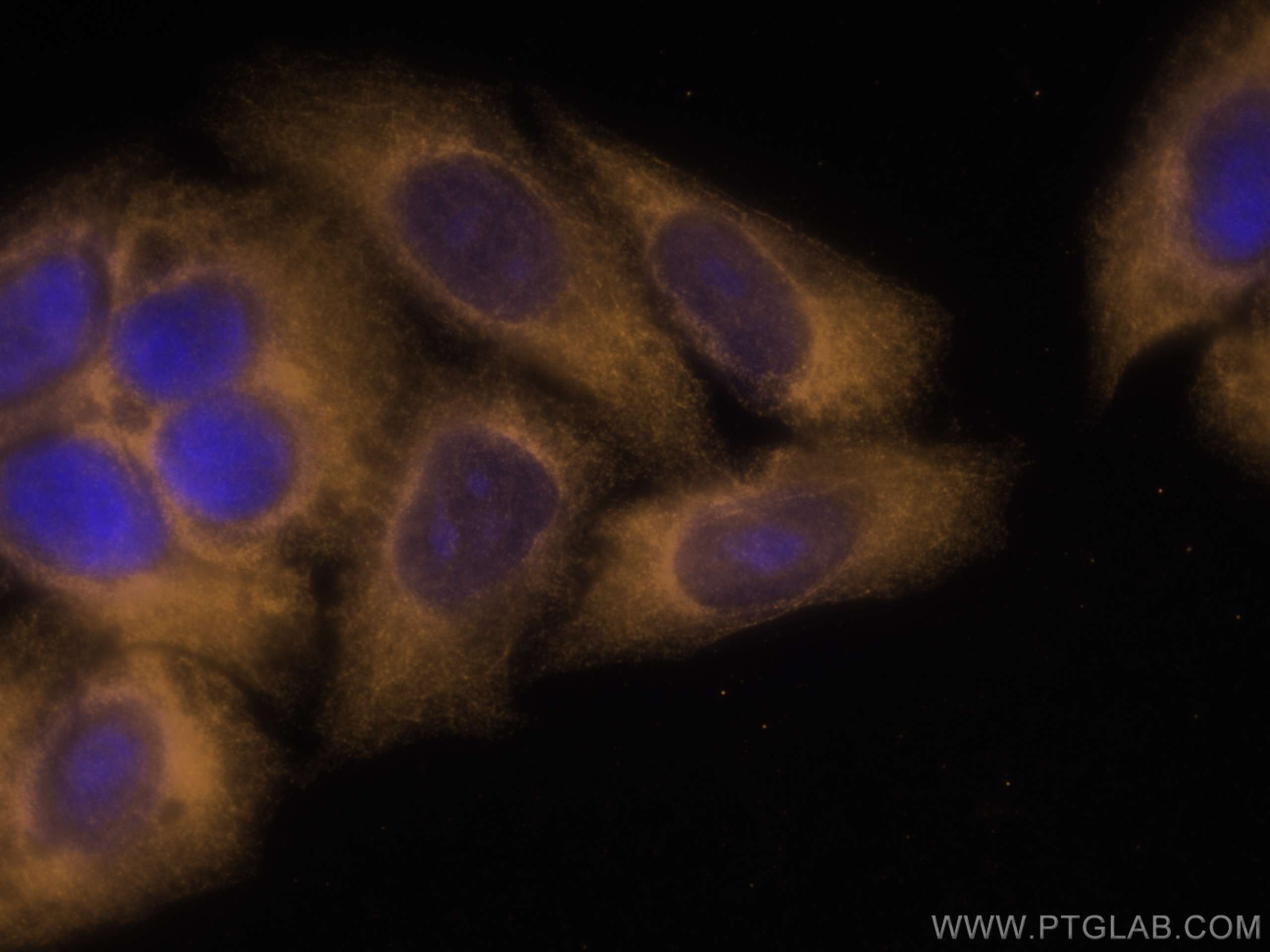 Immunofluorescence (IF) / fluorescent staining of HepG2 cells using CoraLite®555-conjugated LARP1 Monoclonal antibody (CL555-67810)