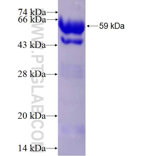 LARP1 fusion protein Ag4645 SDS-PAGE