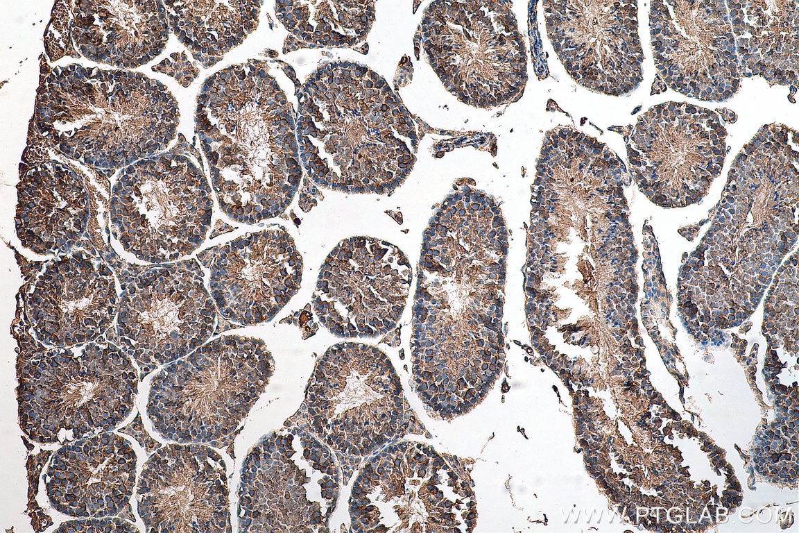 Immunohistochemistry (IHC) staining of mouse testis tissue using LARP2 Polyclonal antibody (17277-1-AP)