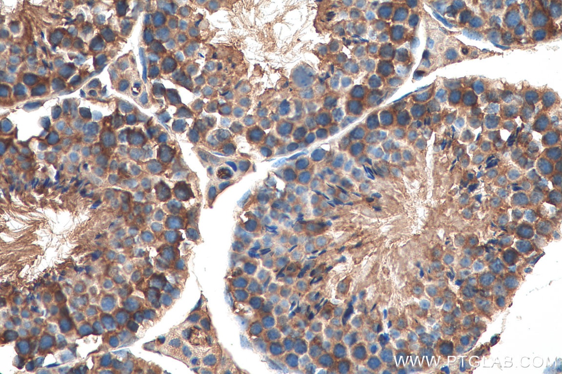 Immunohistochemistry (IHC) staining of mouse testis tissue using LARP2 Polyclonal antibody (17277-1-AP)