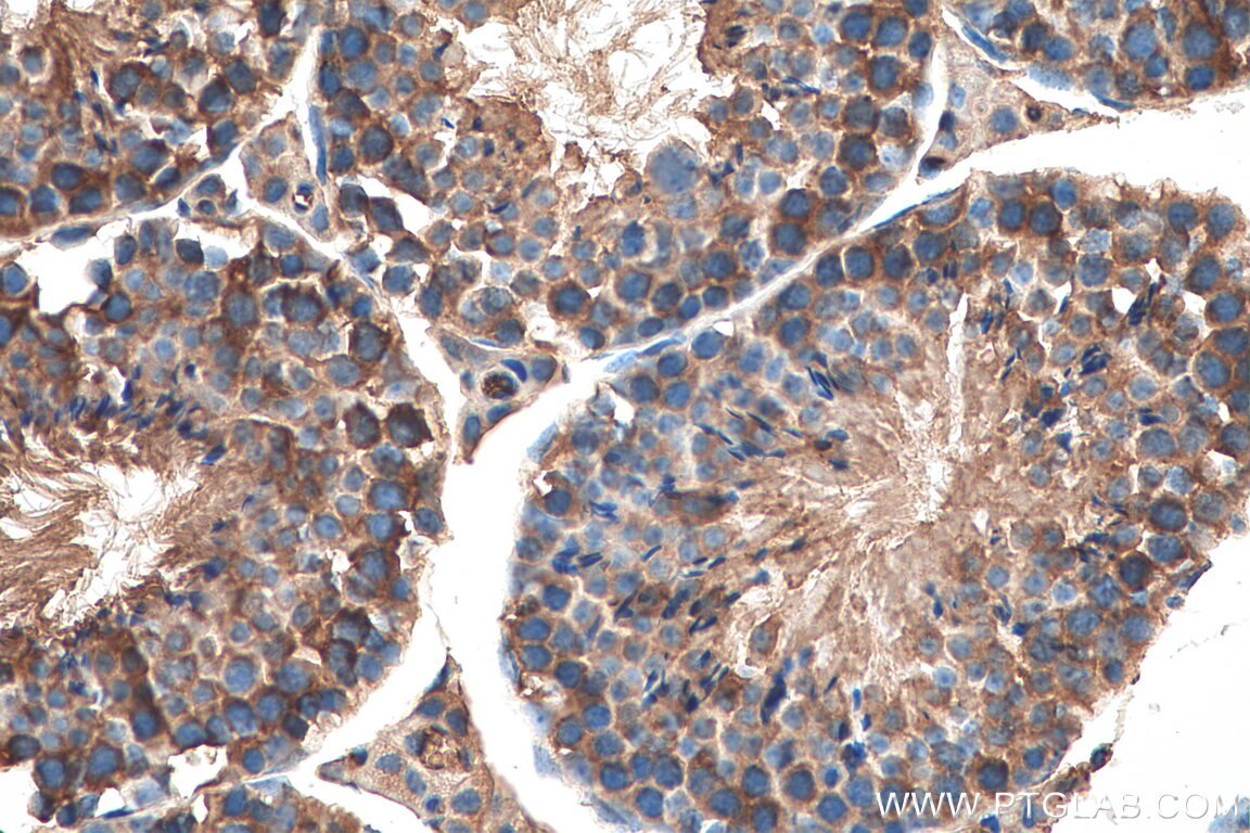 IHC staining of mouse testis using 17277-1-AP