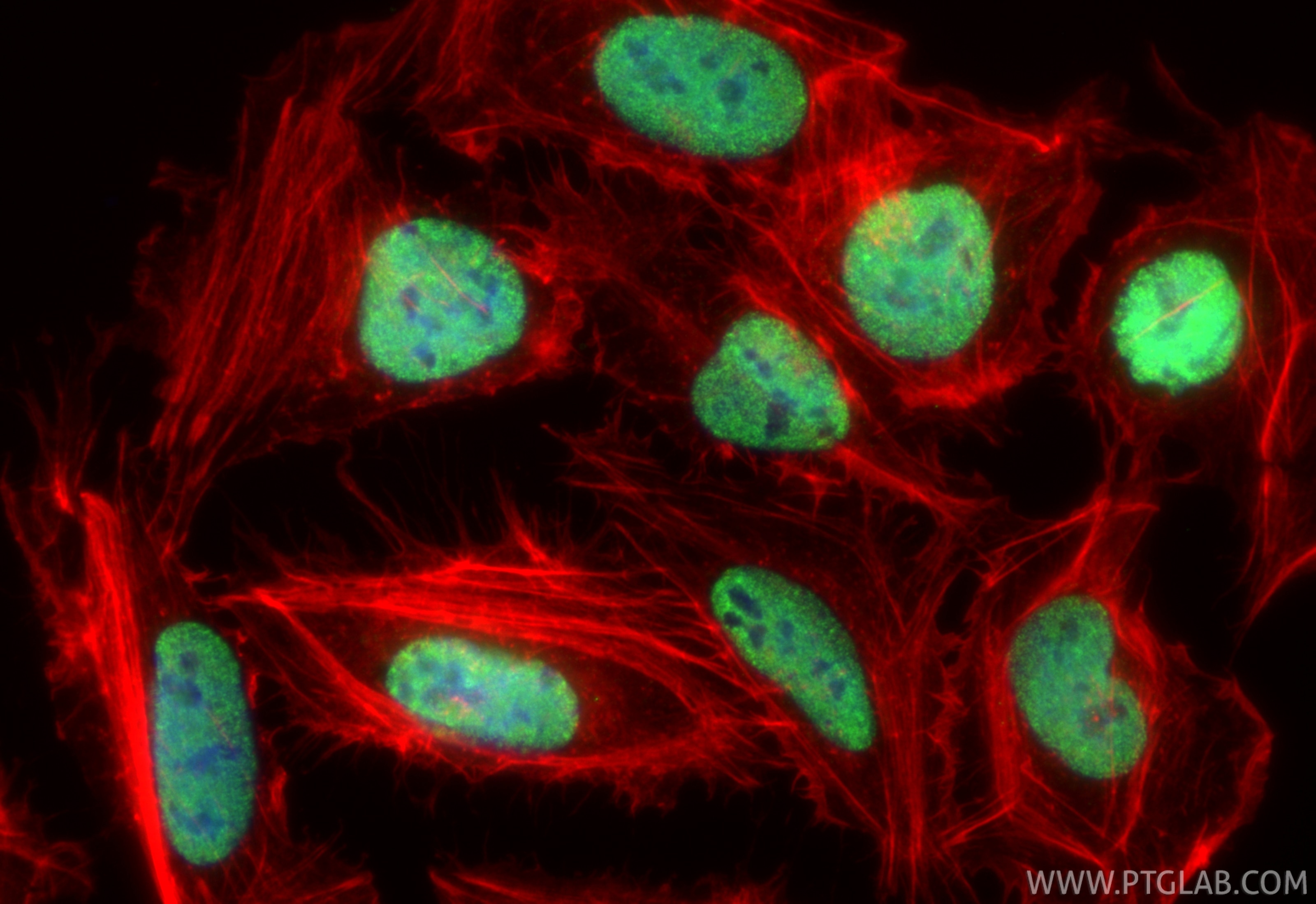 Immunofluorescence (IF) / fluorescent staining of U2OS cells using LARP2 Recombinant antibody (84898-3-RR)