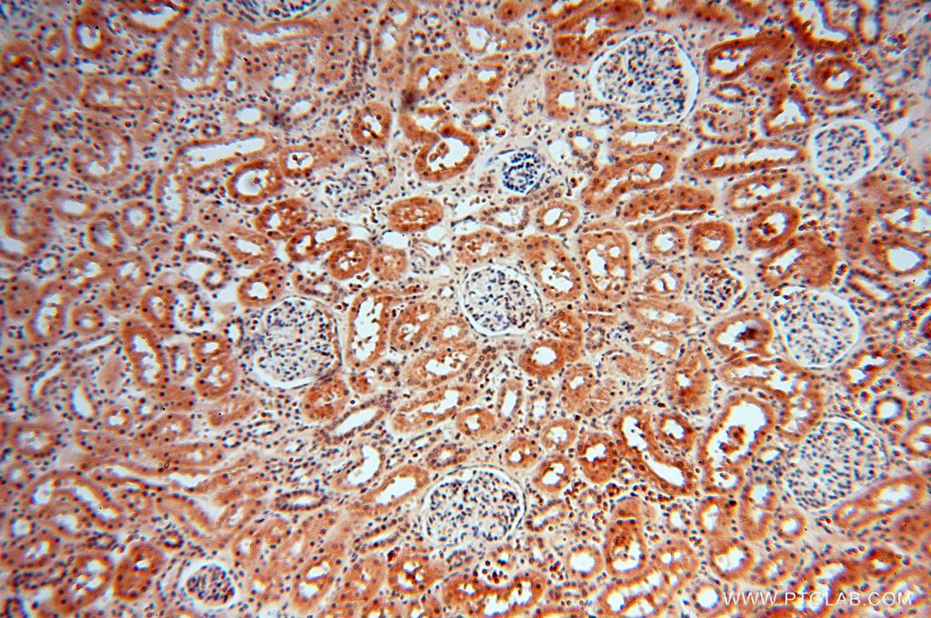IHC staining of human kidney using 16529-1-AP