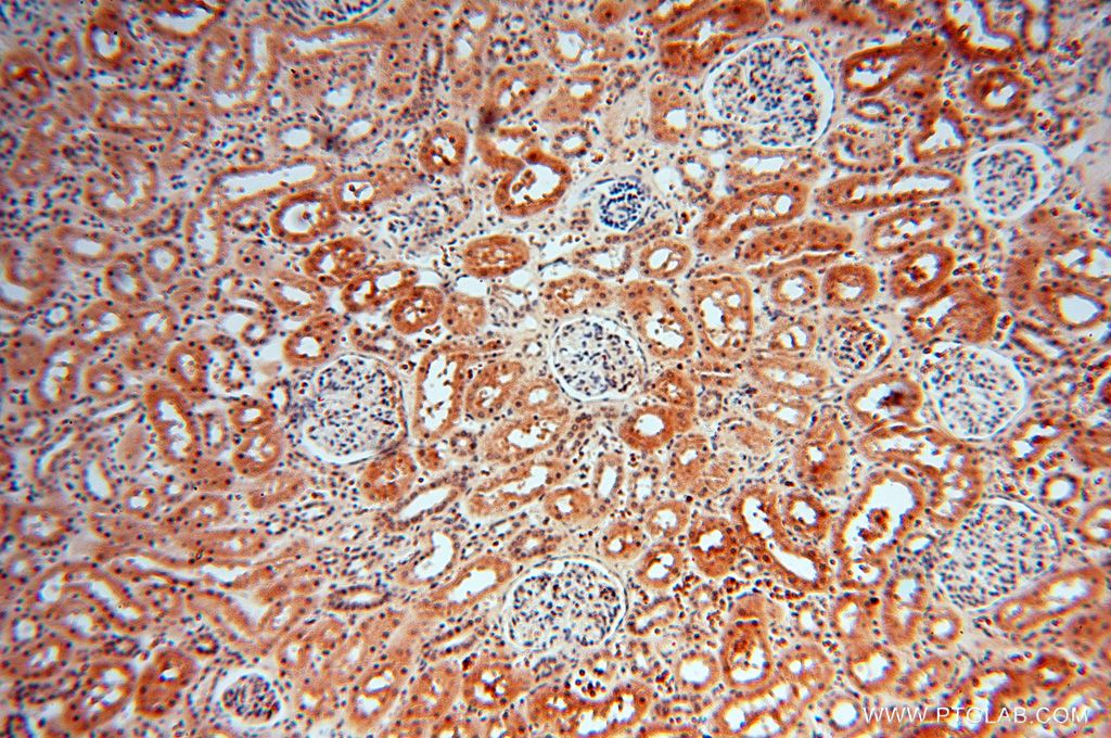 Immunohistochemistry (IHC) staining of human kidney tissue using LARP4 Polyclonal antibody (16529-1-AP)