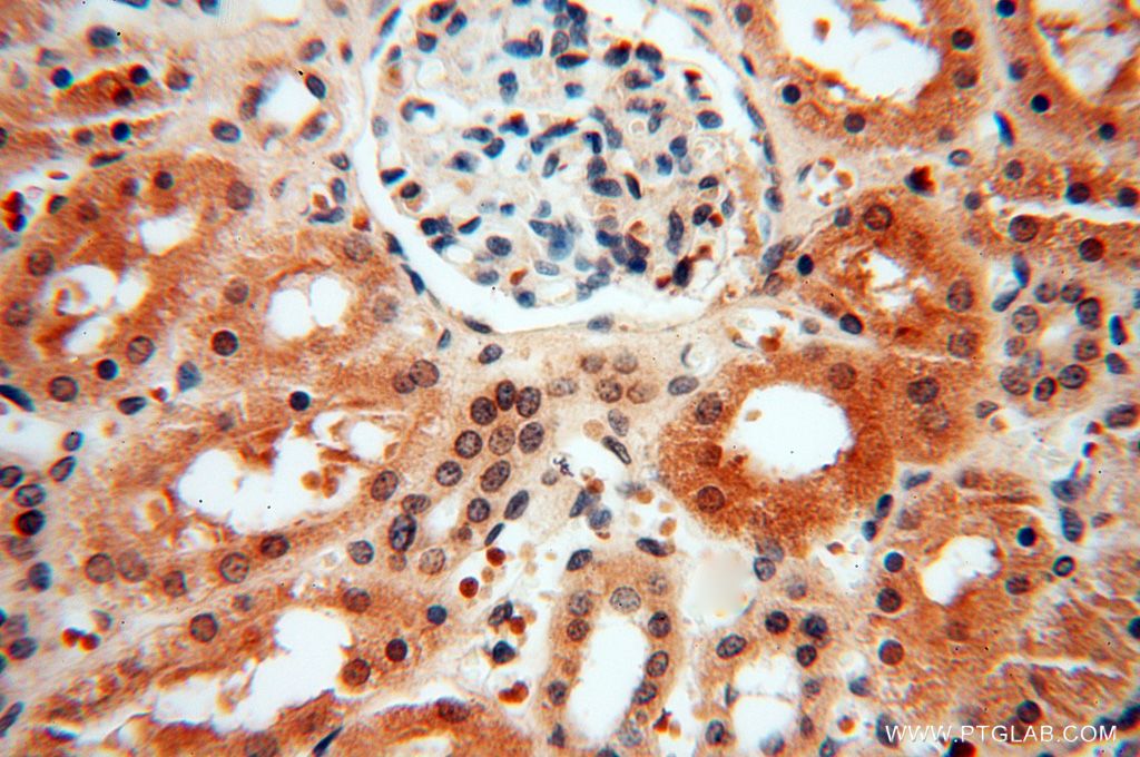 Immunohistochemistry (IHC) staining of human kidney tissue using LARP4 Polyclonal antibody (16529-1-AP)