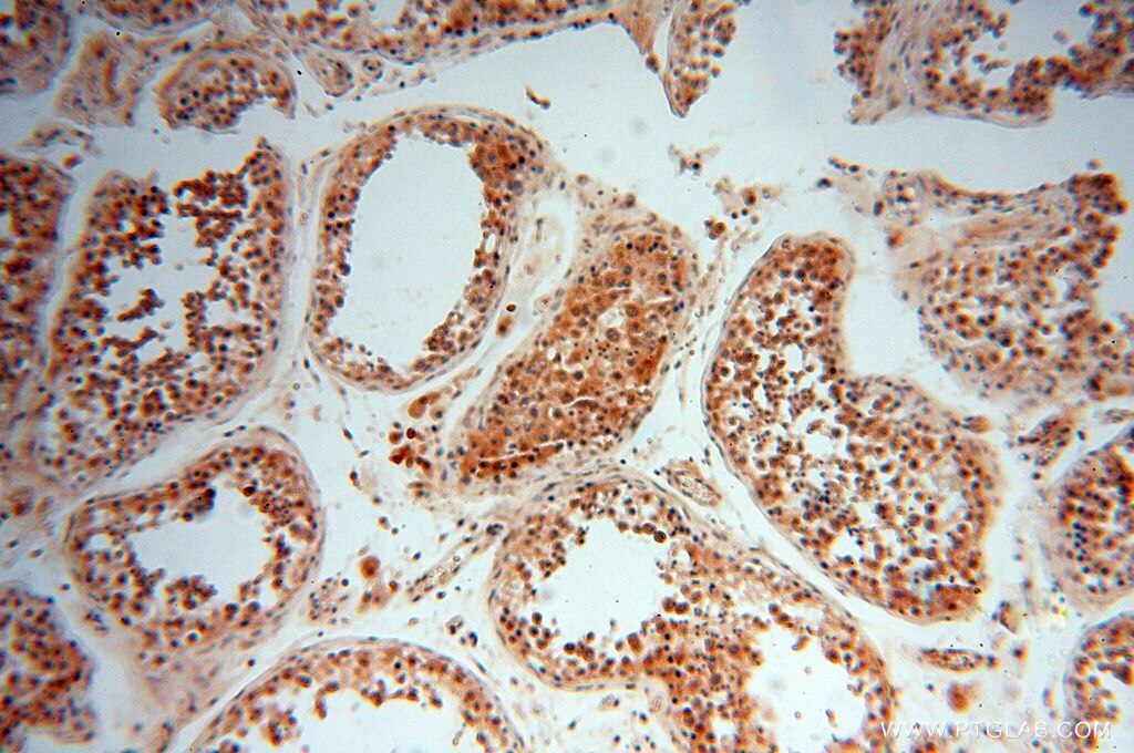 Immunohistochemistry (IHC) staining of human testis tissue using LARP4 Polyclonal antibody (16529-1-AP)