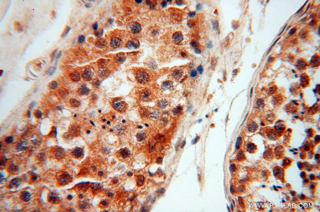 Immunohistochemistry (IHC) staining of human testis tissue using LARP4 Polyclonal antibody (16529-1-AP)