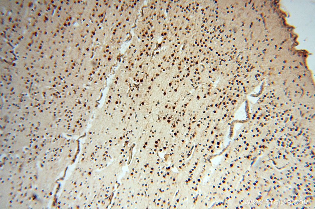 Immunohistochemistry (IHC) staining of human brain tissue using LARP4 Polyclonal antibody (16529-1-AP)