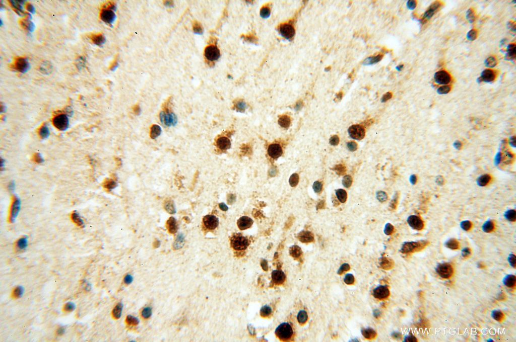 Immunohistochemistry (IHC) staining of human brain tissue using LARP4 Polyclonal antibody (16529-1-AP)