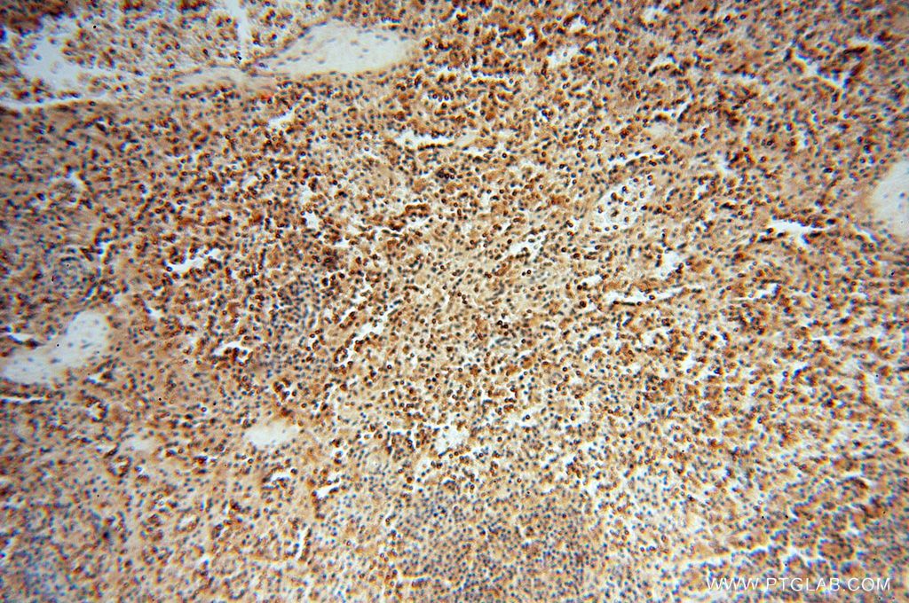 Immunohistochemistry (IHC) staining of human spleen tissue using LARP4 Polyclonal antibody (16529-1-AP)