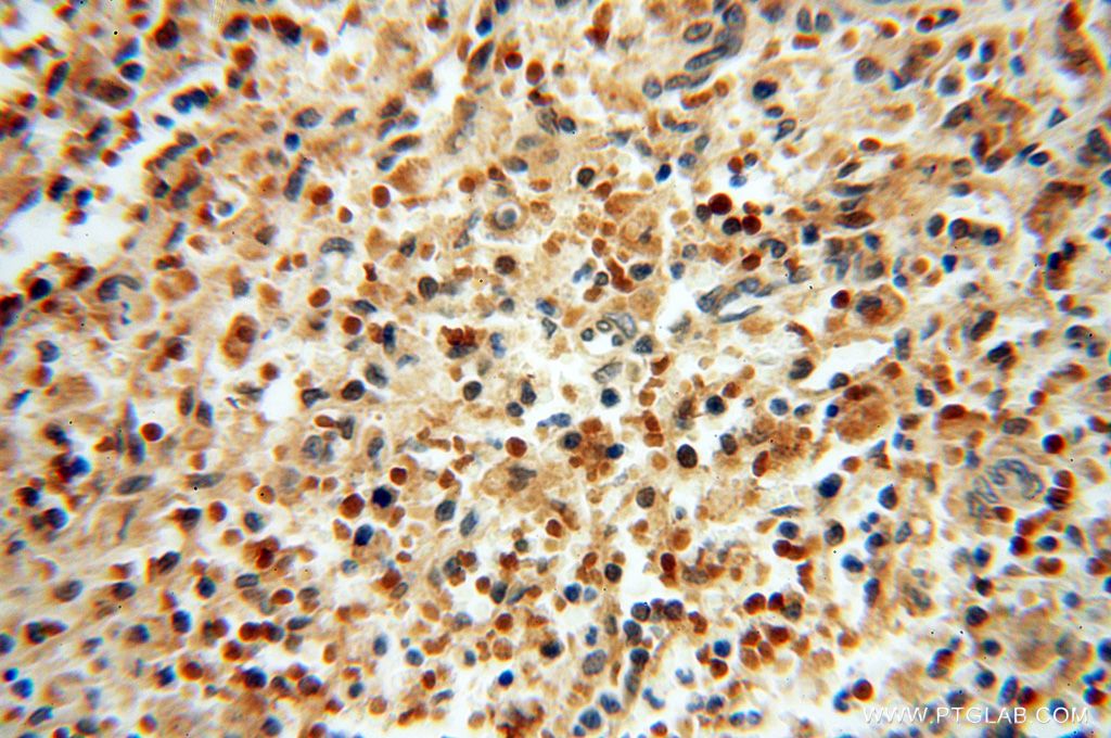Immunohistochemistry (IHC) staining of human spleen tissue using LARP4 Polyclonal antibody (16529-1-AP)