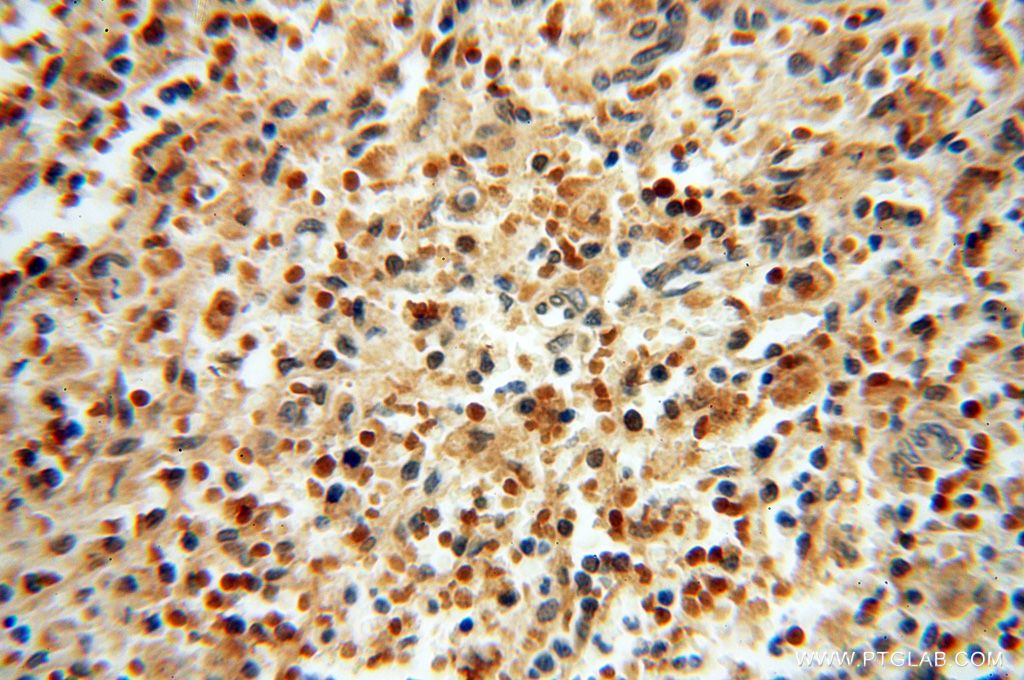 IHC staining of human spleen using 16529-1-AP