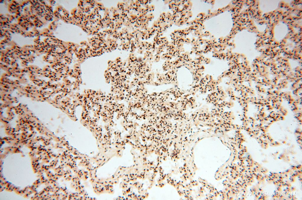Immunohistochemistry (IHC) staining of human lung tissue using LARP4 Polyclonal antibody (16529-1-AP)