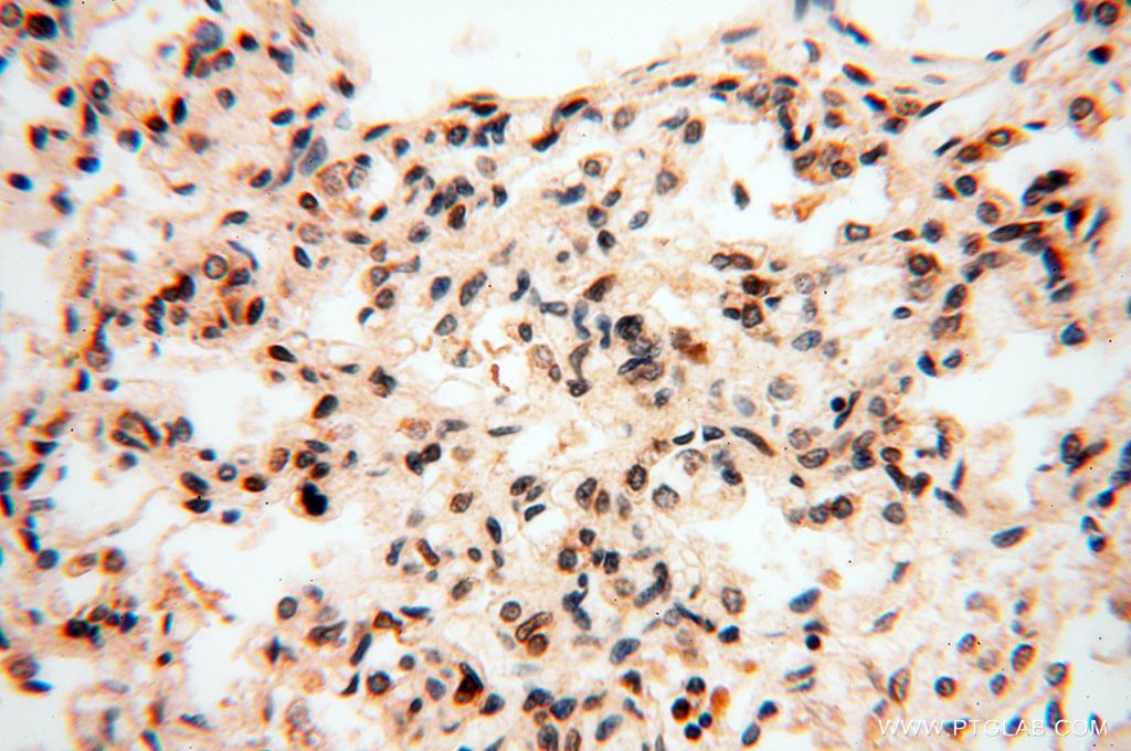 Immunohistochemistry (IHC) staining of human lung tissue using LARP4 Polyclonal antibody (16529-1-AP)
