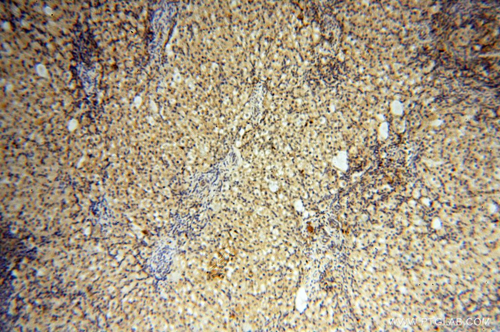 Immunohistochemistry (IHC) staining of human ovary tissue using LARP4 Polyclonal antibody (16529-1-AP)