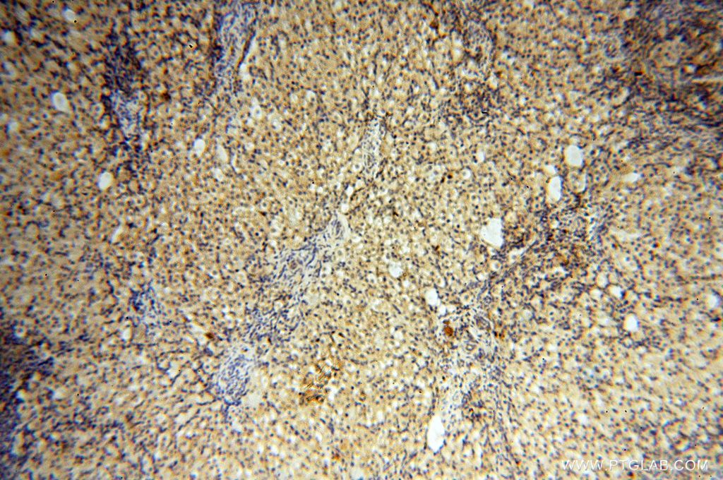 IHC staining of human ovary using 16529-1-AP