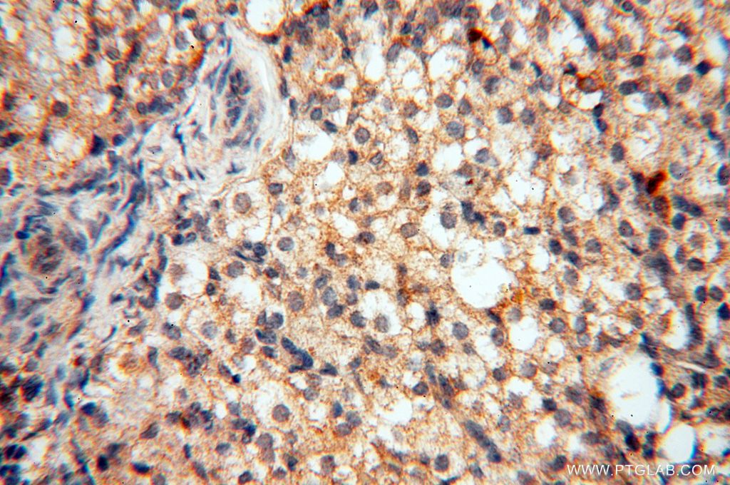 Immunohistochemistry (IHC) staining of human ovary tissue using LARP4 Polyclonal antibody (16529-1-AP)