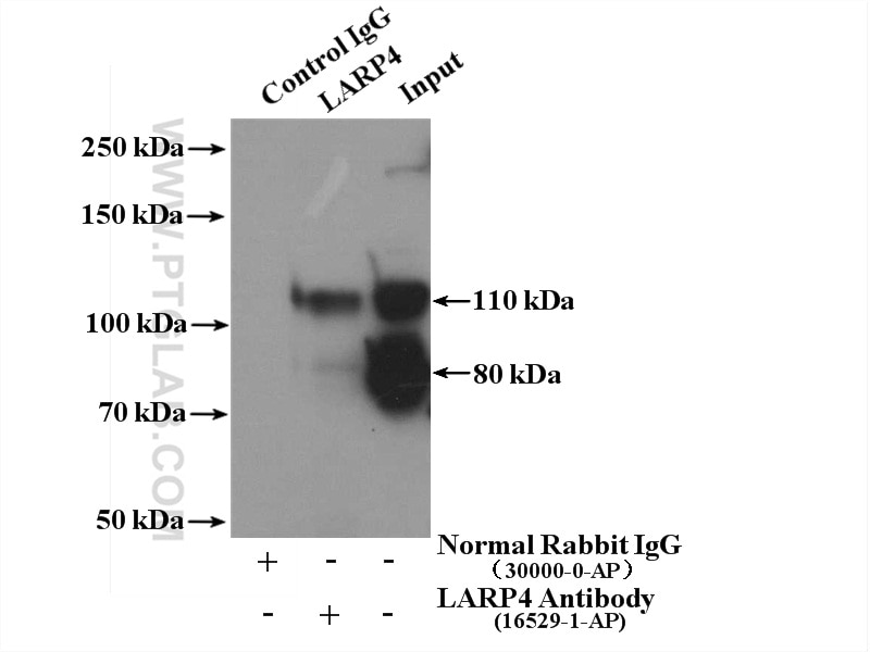 Immunoprecipitation (IP) experiment of Y79 cells using LARP4 Polyclonal antibody (16529-1-AP)