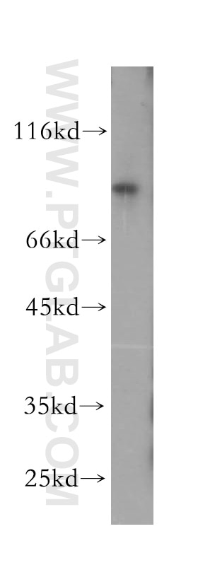 Western Blot (WB) analysis of Y79 cells using LARP4 Polyclonal antibody (16529-1-AP)