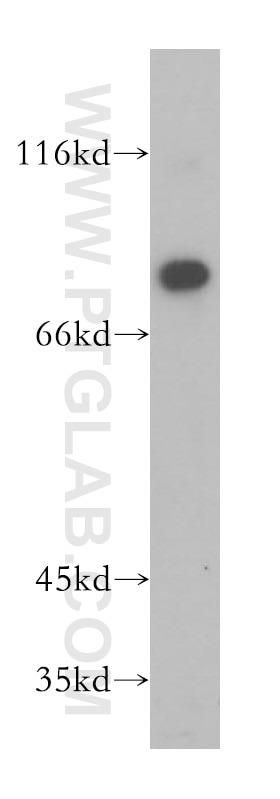 Western Blot (WB) analysis of Y79 cells using LARP4 Polyclonal antibody (16529-1-AP)
