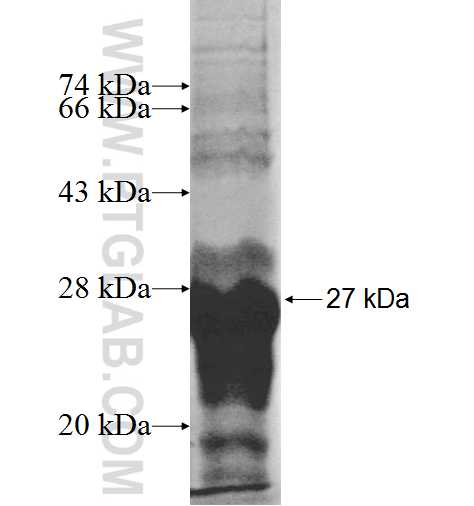 LARP4 fusion protein Ag9696 SDS-PAGE