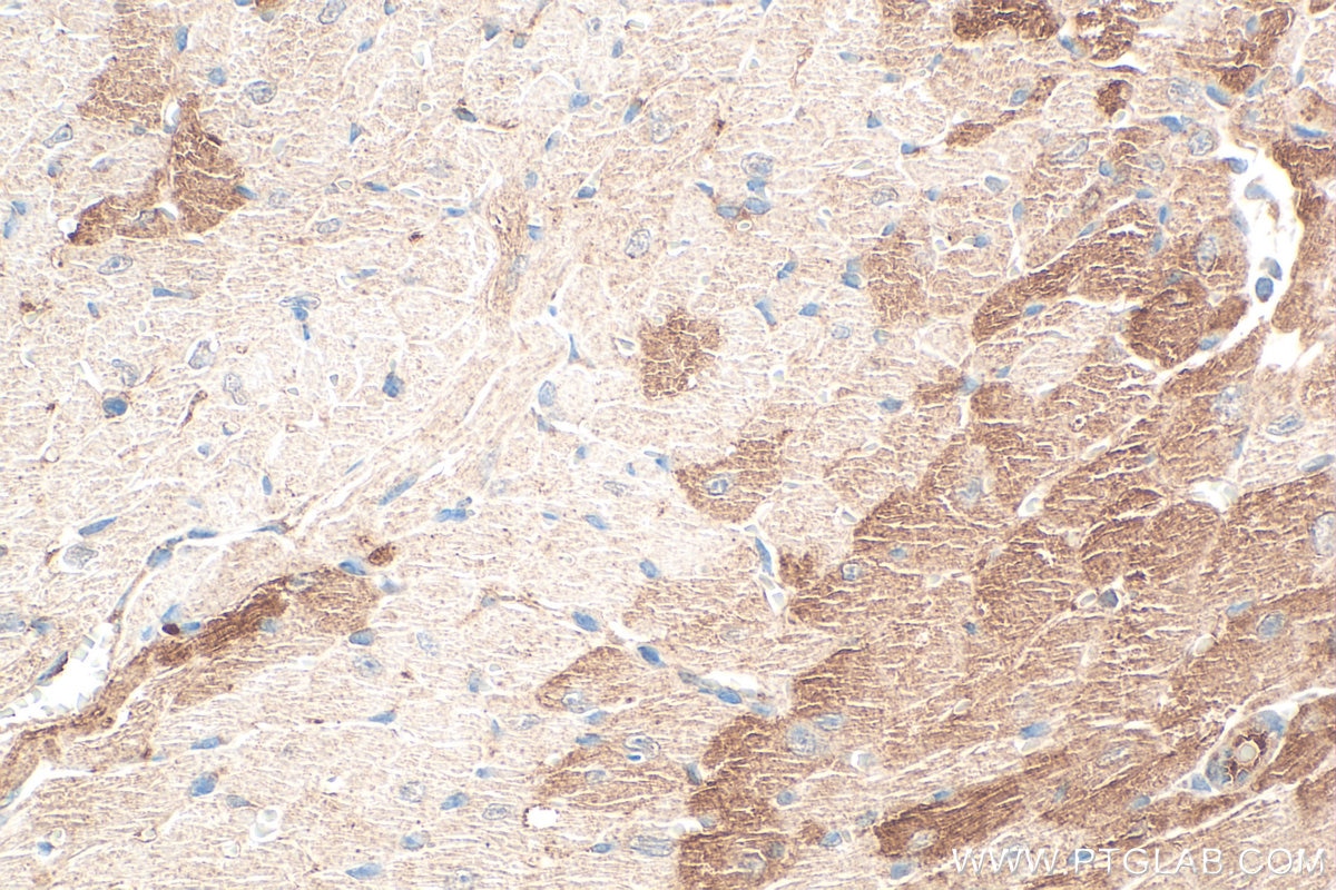 Immunohistochemistry (IHC) staining of mouse heart tissue using LARP6 Polyclonal antibody (27514-1-AP)