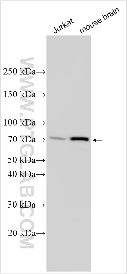 Western Blot (WB) analysis of various lysates using LARP6 Polyclonal antibody (27514-1-AP)