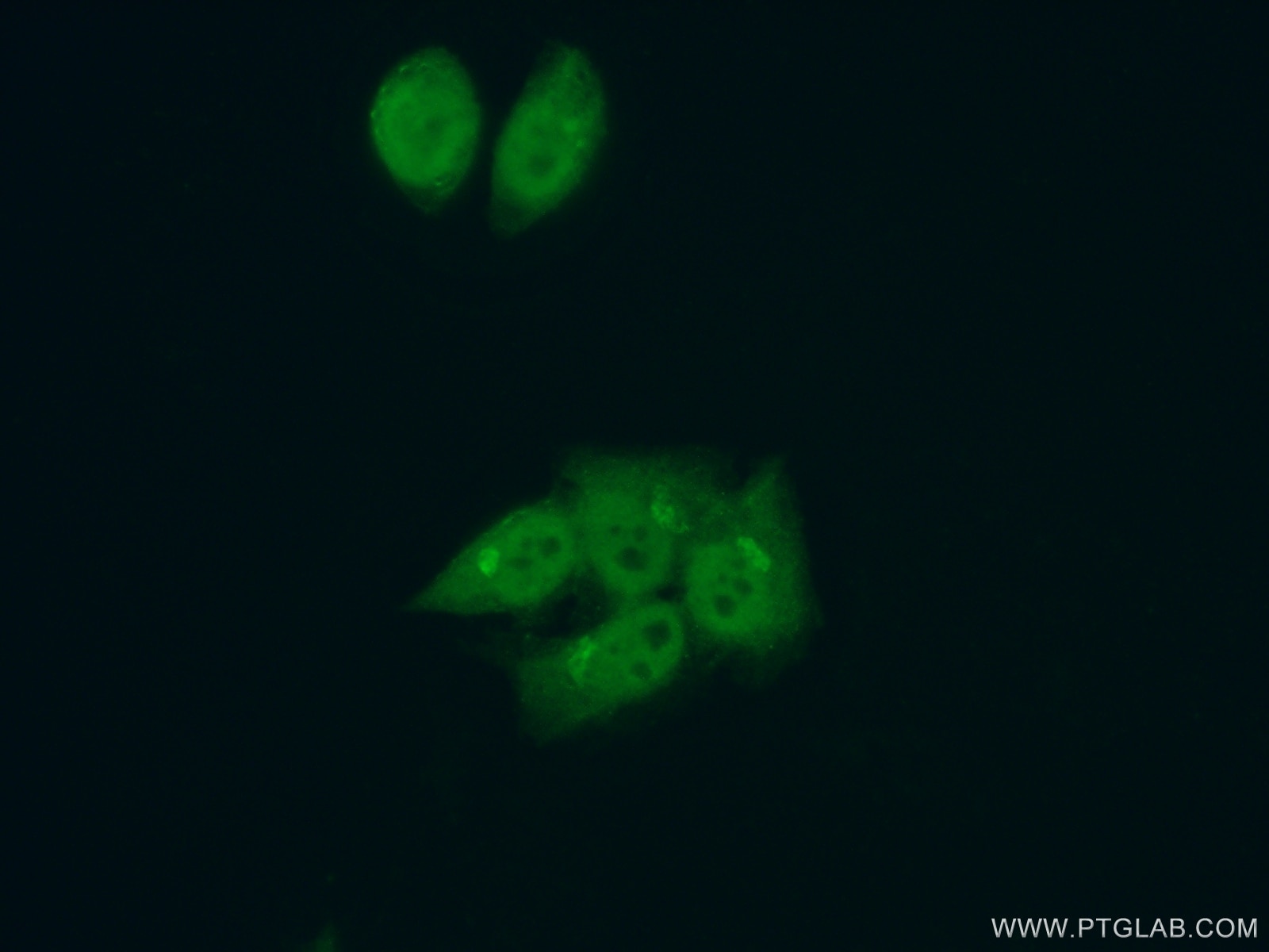 Immunofluorescence (IF) / fluorescent staining of HeLa cells using LARP7 Polyclonal antibody (17067-1-AP)