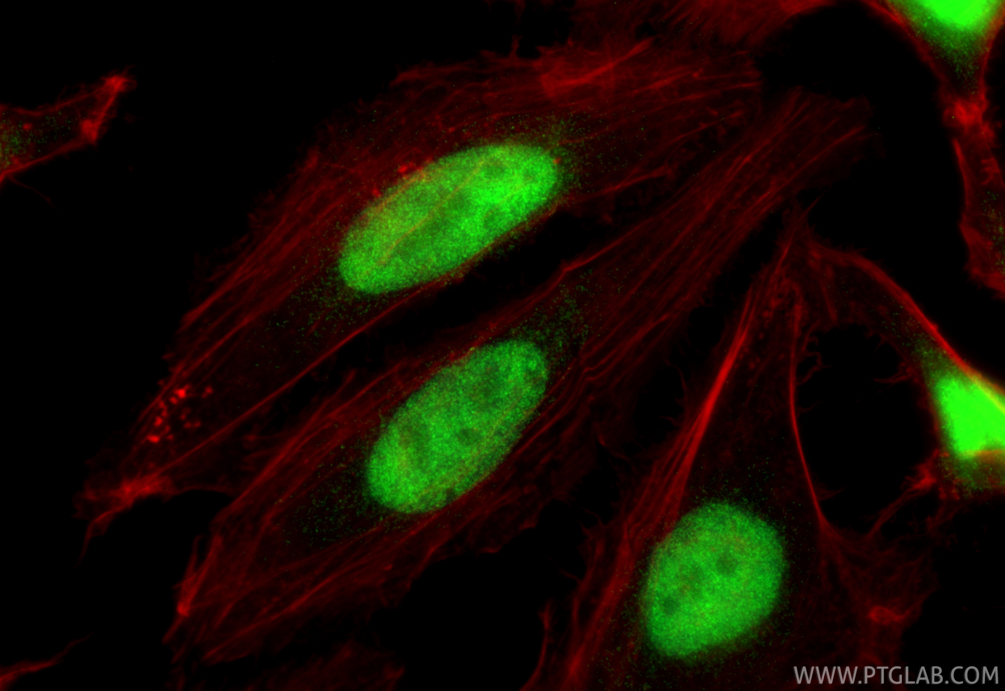 Immunofluorescence (IF) / fluorescent staining of HeLa cells using LARP7 Polyclonal antibody (17067-1-AP)