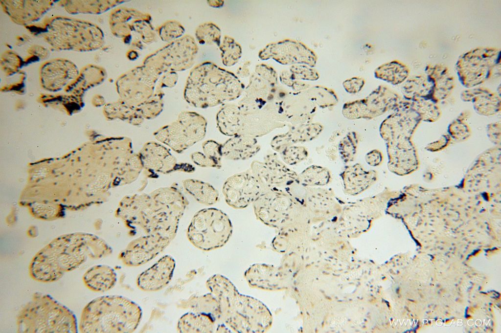 Immunohistochemistry (IHC) staining of human placenta tissue using LARP7 Polyclonal antibody (17067-1-AP)
