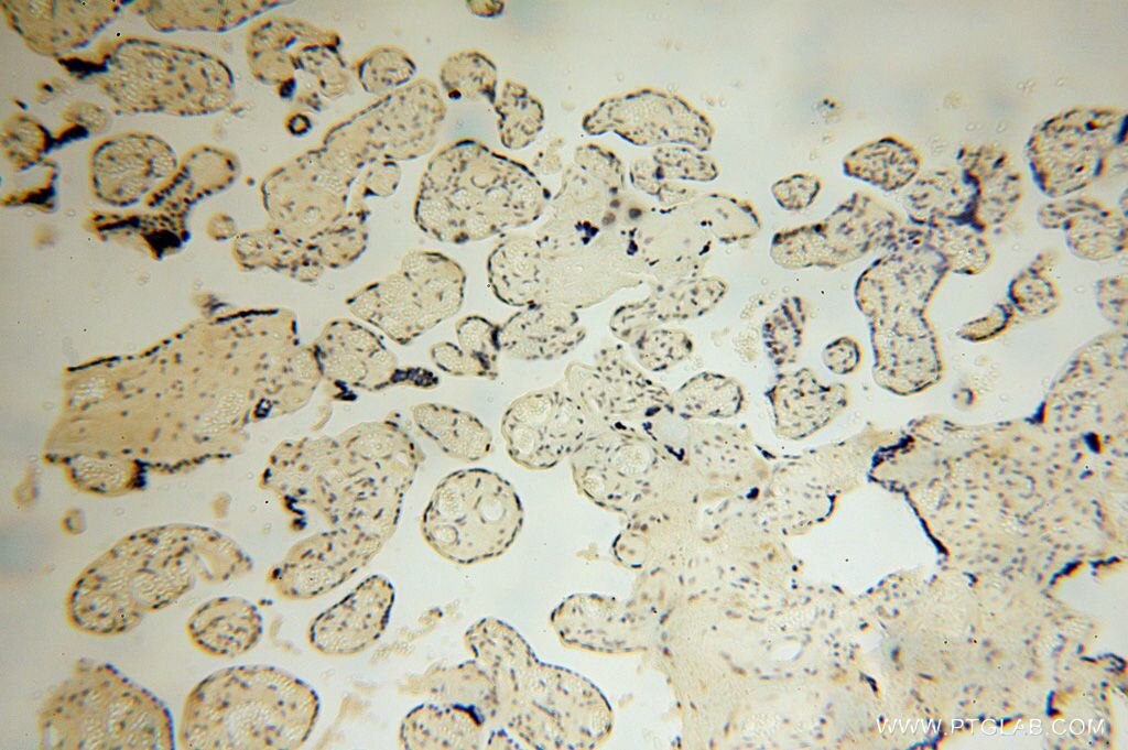 IHC staining of human placenta using 17067-1-AP