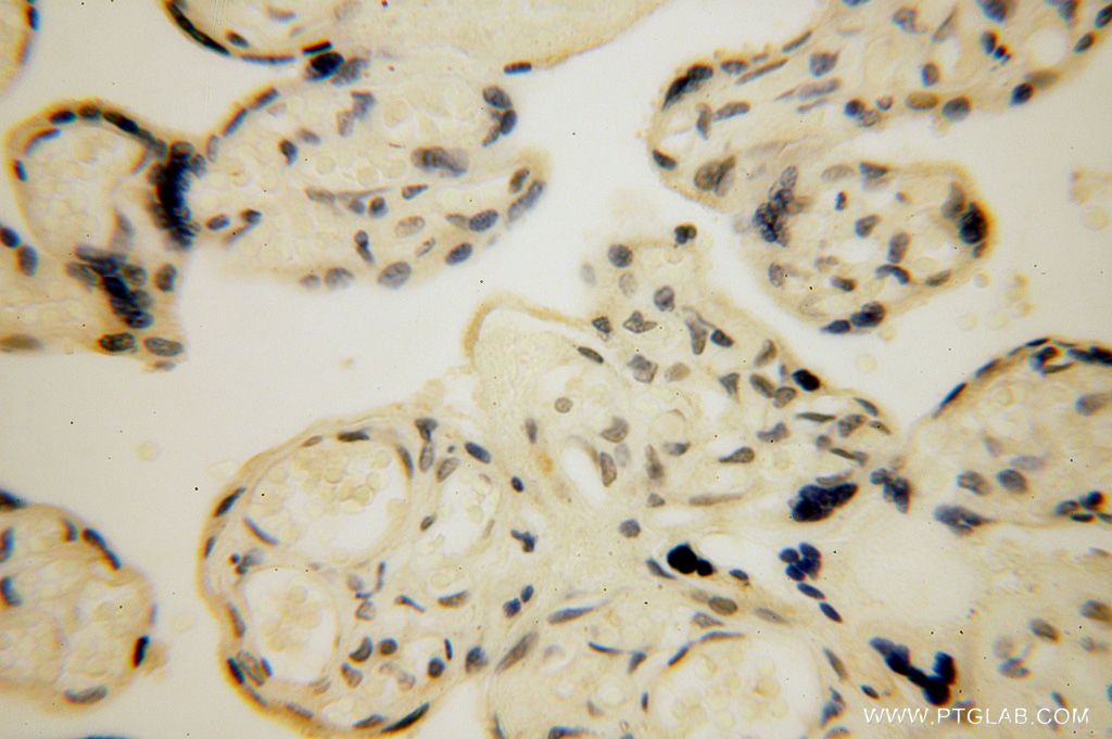 Immunohistochemistry (IHC) staining of human placenta tissue using LARP7 Polyclonal antibody (17067-1-AP)