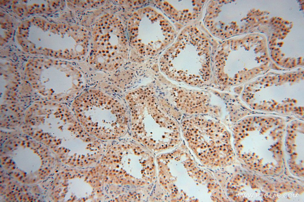 Immunohistochemistry (IHC) staining of human testis tissue using LARP7 Polyclonal antibody (17067-1-AP)