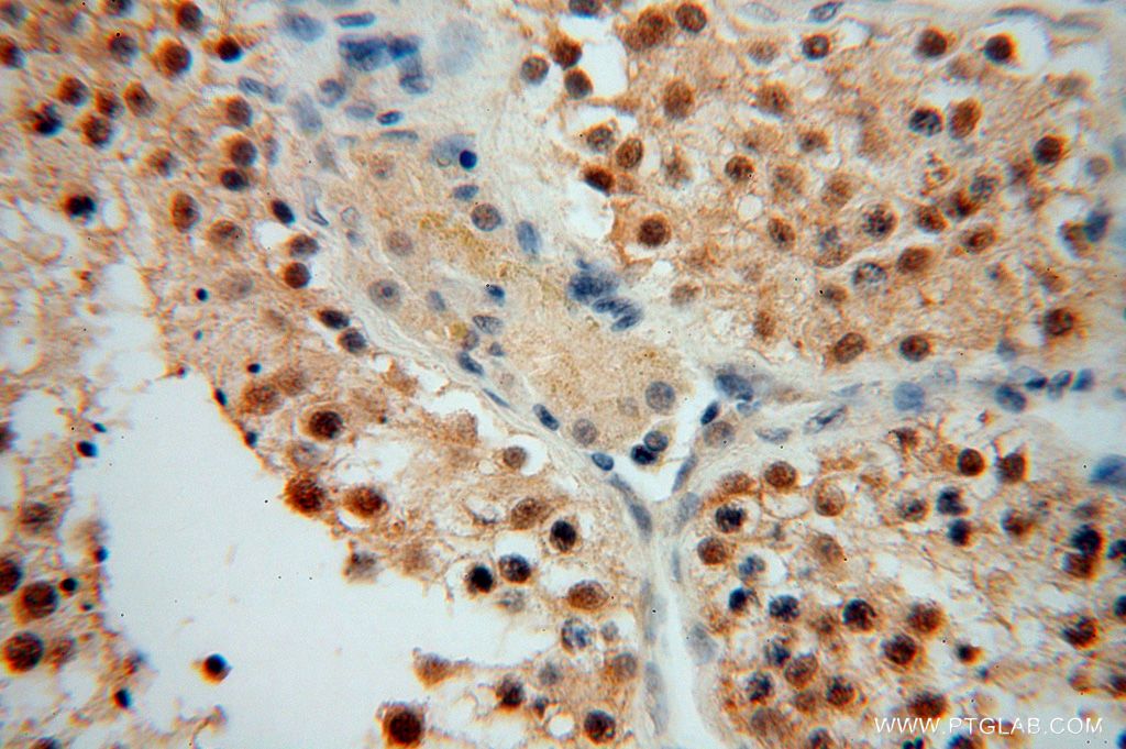 IHC staining of human testis using 17067-1-AP