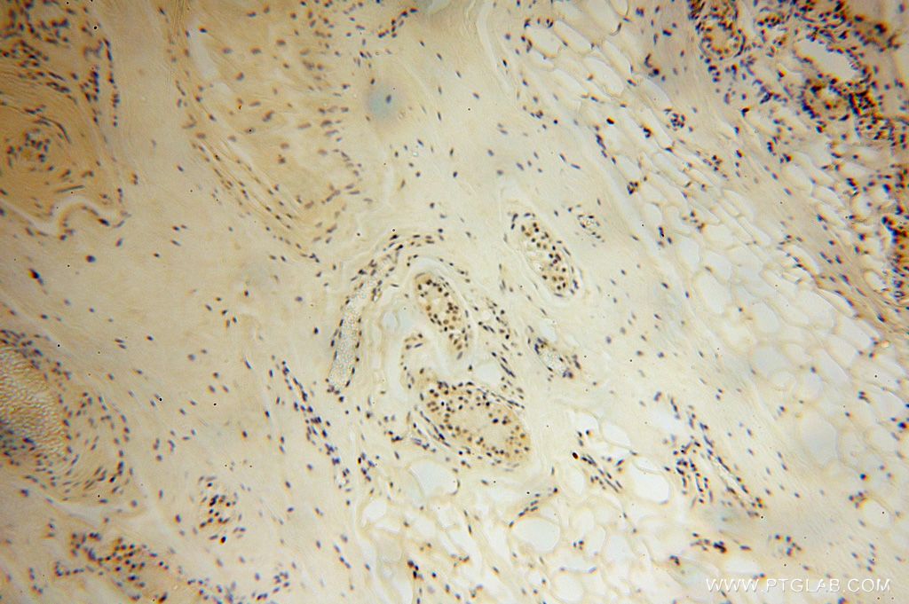 Immunohistochemistry (IHC) staining of human skin tissue using LARP7 Polyclonal antibody (17067-1-AP)