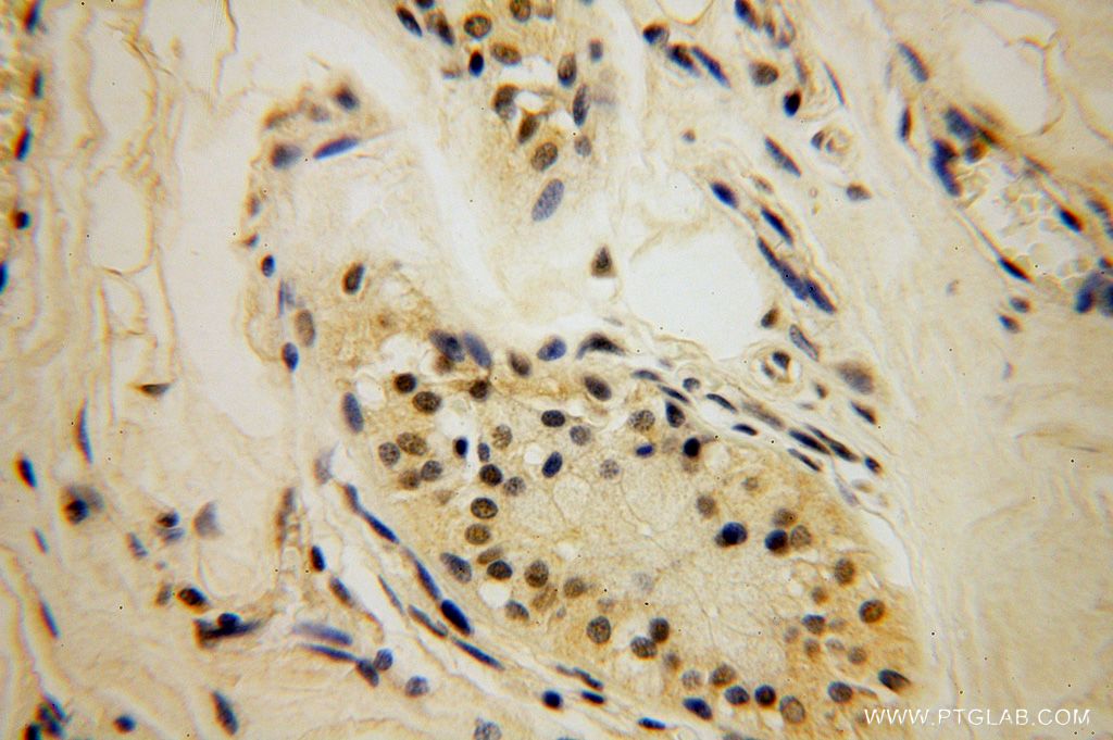 Immunohistochemistry (IHC) staining of human skin tissue using LARP7 Polyclonal antibody (17067-1-AP)