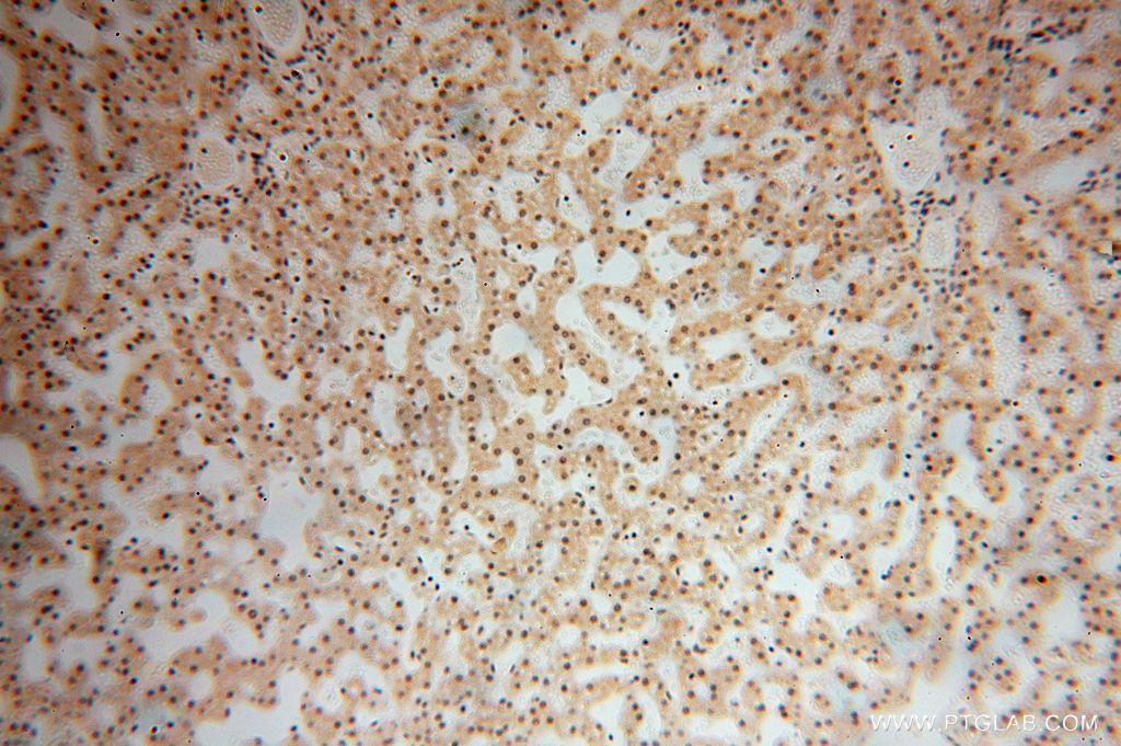 Immunohistochemistry (IHC) staining of human liver tissue using LARP7 Polyclonal antibody (17067-1-AP)