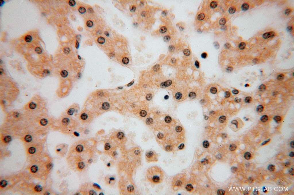 Immunohistochemistry (IHC) staining of human liver tissue using LARP7 Polyclonal antibody (17067-1-AP)