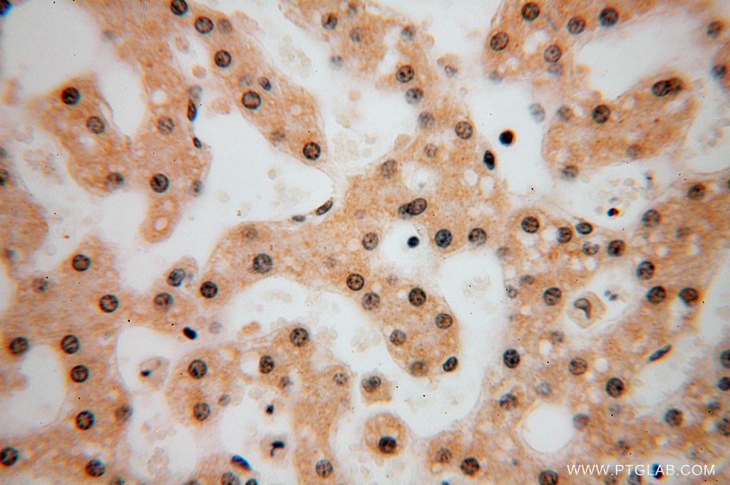 IHC staining of human liver using 17067-1-AP